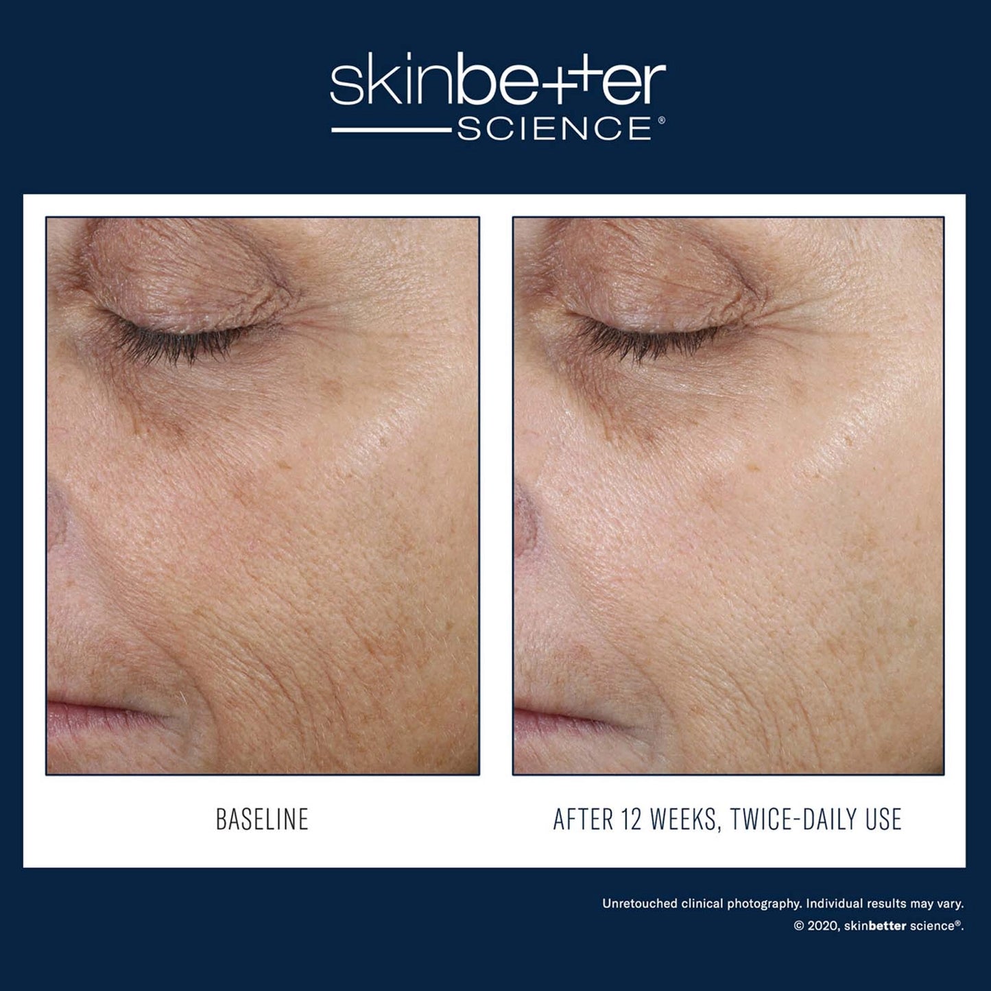 Skinbetter Science: Even Tone Correcting Serum 50ml