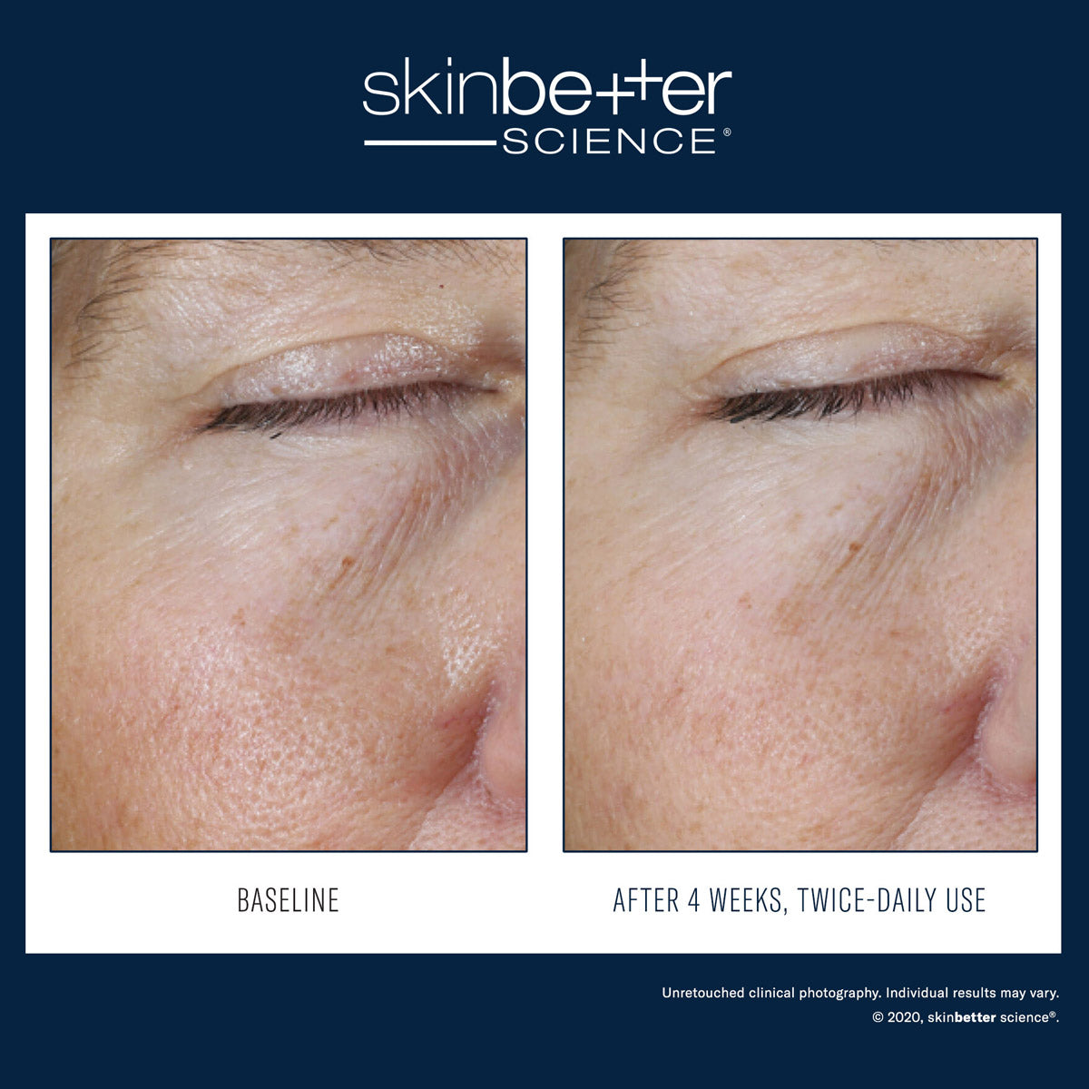 Skinbetter Science : Gel YEUX à effet instantané 15 ml